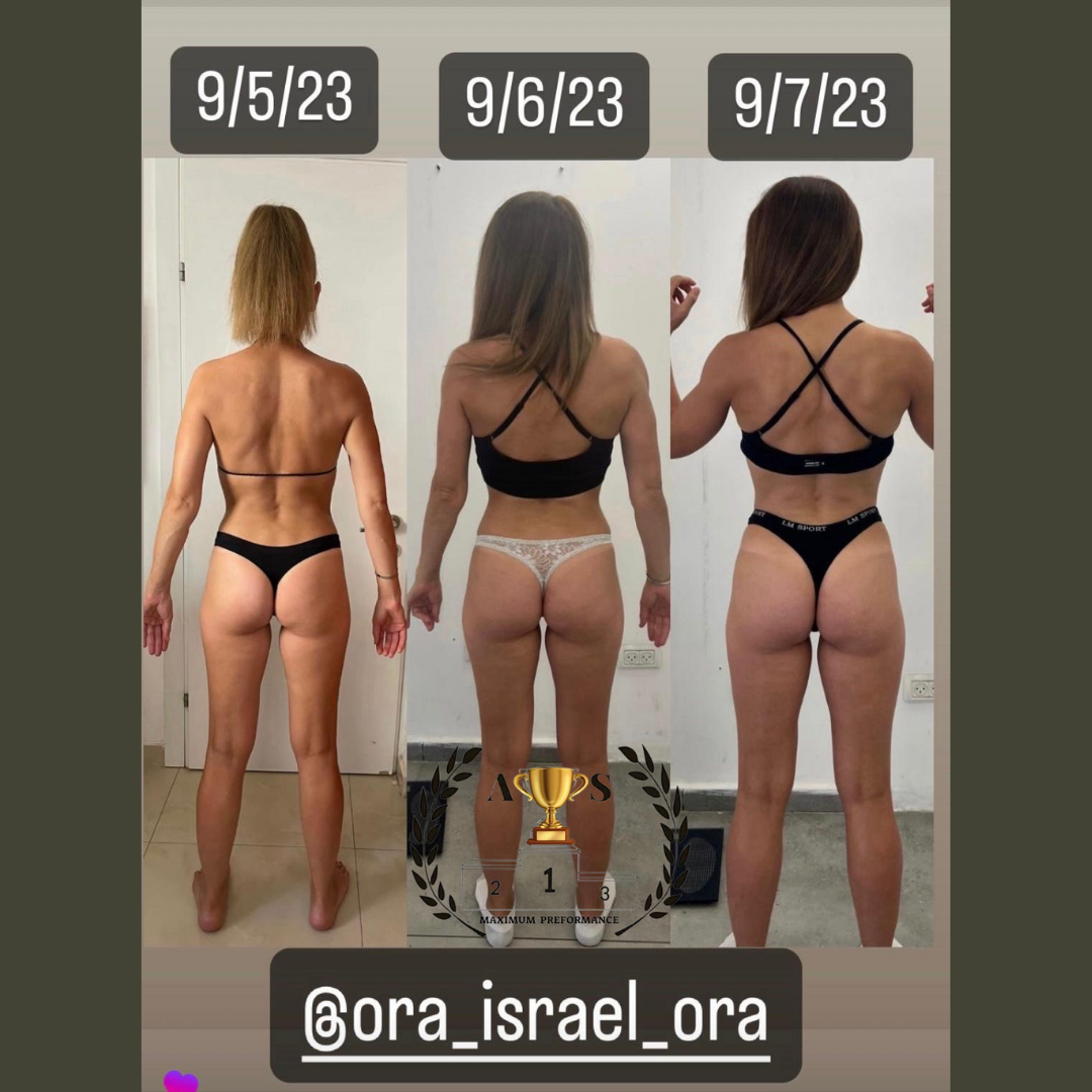 Before After 13